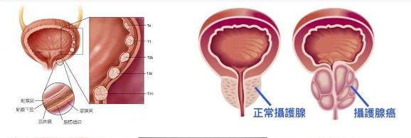 201901211548038559198471.png 攝護腺肥大