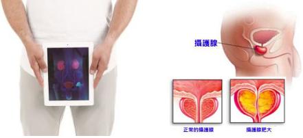 201902181550453140568260.png 陽痿早洩疾病